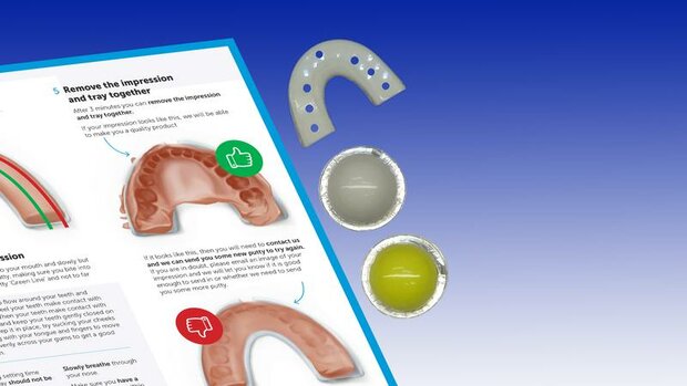 Knarsbitje op maat Standard AM (antimicrobieel)  – 3.0 mm