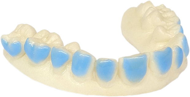 Bleekbitje op Maat - Teeth Whitening Custom